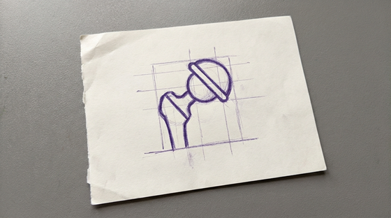 a prosthetic hip joint